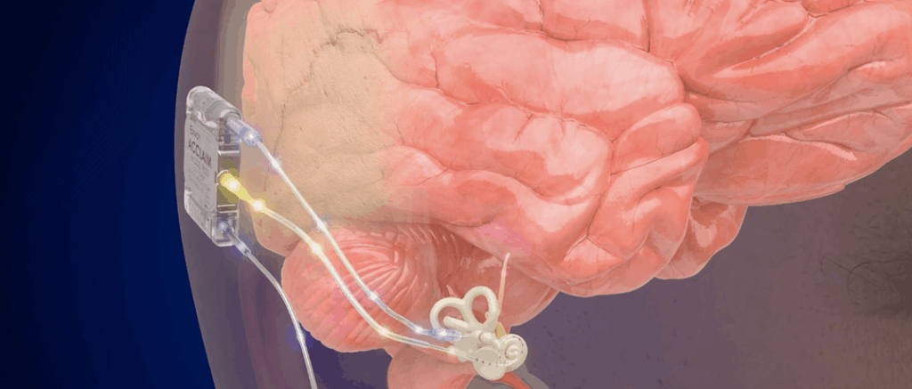 3D Medical Animation