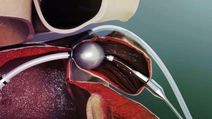 slideshow4